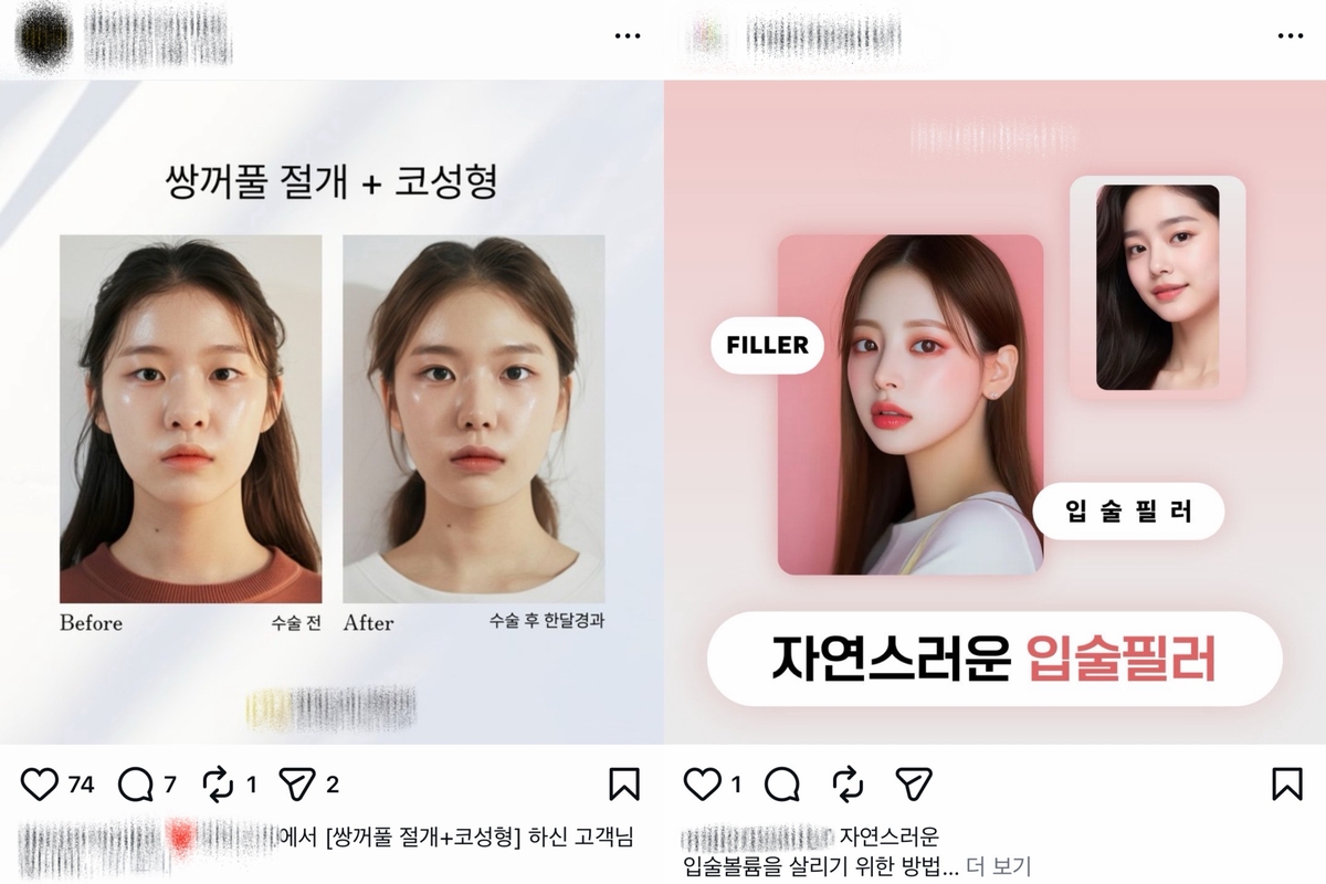 인공지능(AI) 모델로 홍보하는 성형외과